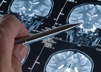 “Los resultados son sorprendentes”: la insólita conexión entre las finanzas personales y el Alzheimer que registró un estudio