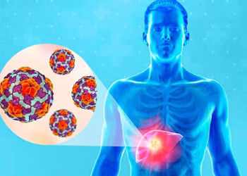 Día Mundial de la Hepatitis: por qué está subdiagnosticada y cuáles son los últimos avances para su tratamiento