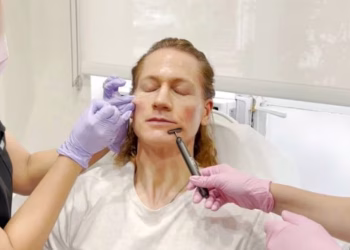 Un empresario multimillonario gastó más de USD 2 millones para verse más joven, pero el tratamiento no salió como eperaba